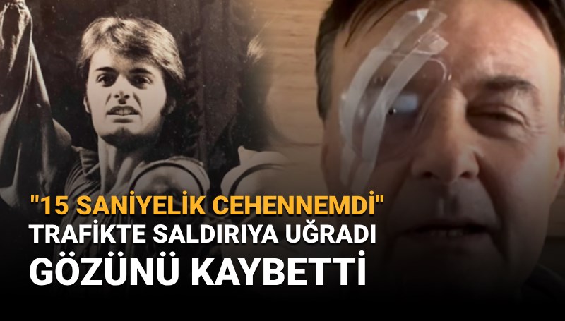West End yıldızı trafikte saldırıya uğradı, sağ gözünü kaybetti