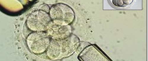 Yeni tüp bebekte Türk kadınına öncelik Sağlık Haberleri