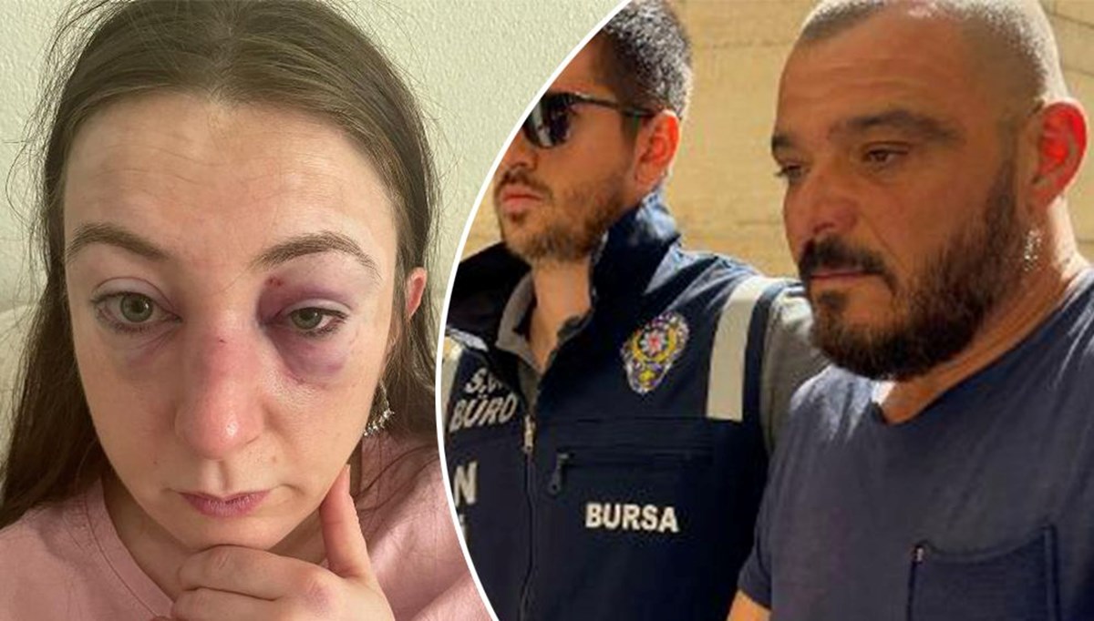 Zorla arabaya bindirip kaçırdı, arabanın içinde 9 kez kafa attı (Genç kadına saldırıya 9 yıl hapis istemi) Zorla arabaya bindirip kaçırdı, arabanın içinde 9 kez kafa attı (Genç kadına saldırıya 9 yıl hapis istemi)