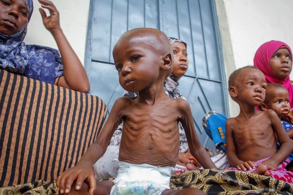 Somali'de 6 ayda en az 200 çocuk yetersiz beslenme nedeniyle öldü - 1
