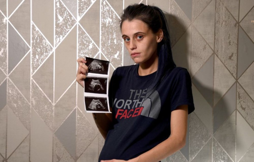 Annelik içgüdüsü kurtardı: Doktorların 'ölü' dediği bebeği canlı doğurdu - 7