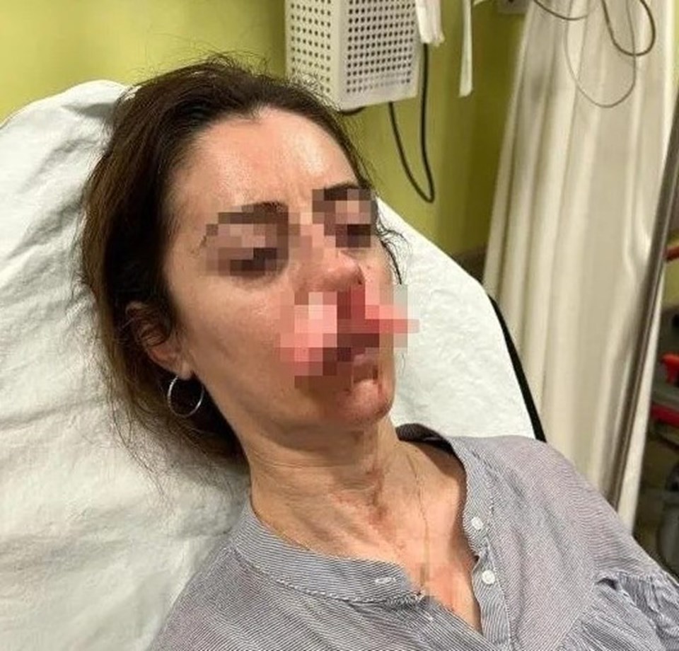 Otomobil kapısı silah sayıldı! Eşinin sevgilisi sandı, arabanın kapısıyla saldırdı - 1