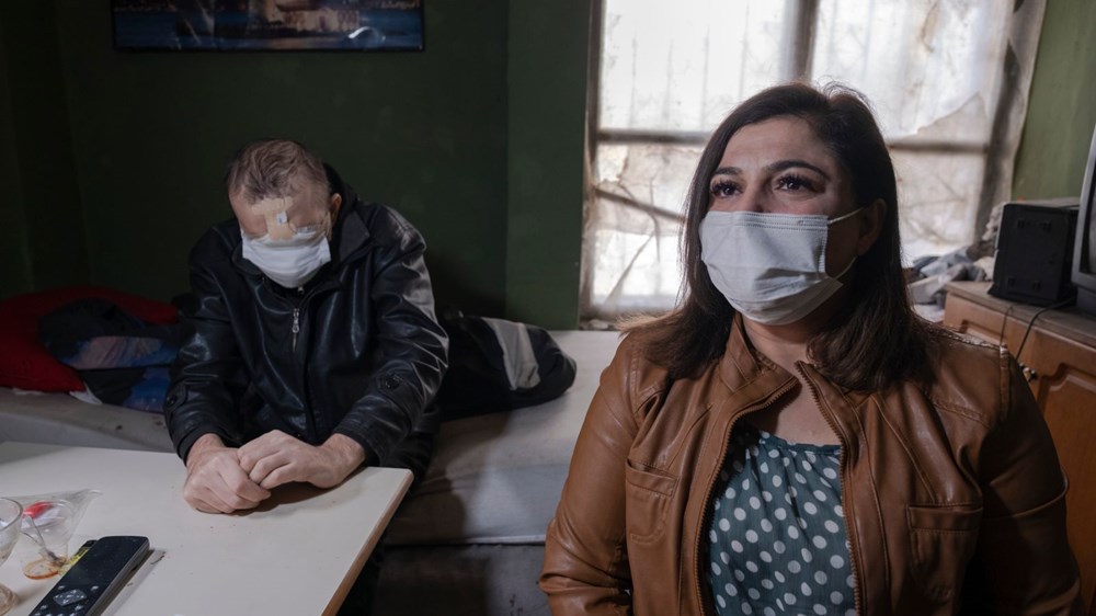 Cilt kanserinden yüzünü kaybeden baba: Kızımı öpmeyi çok özledim - 8