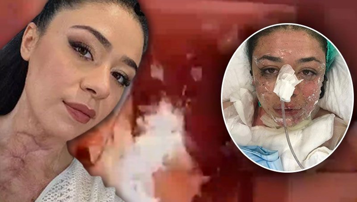 Acil serviste dehşeti anlattı: Çakmak çakıp 'Yakayım mı sizi' diye sormuş Acil serviste dehşeti anlattı: Çakmak çakıp 'Yakayım mı sizi' diye sormuş