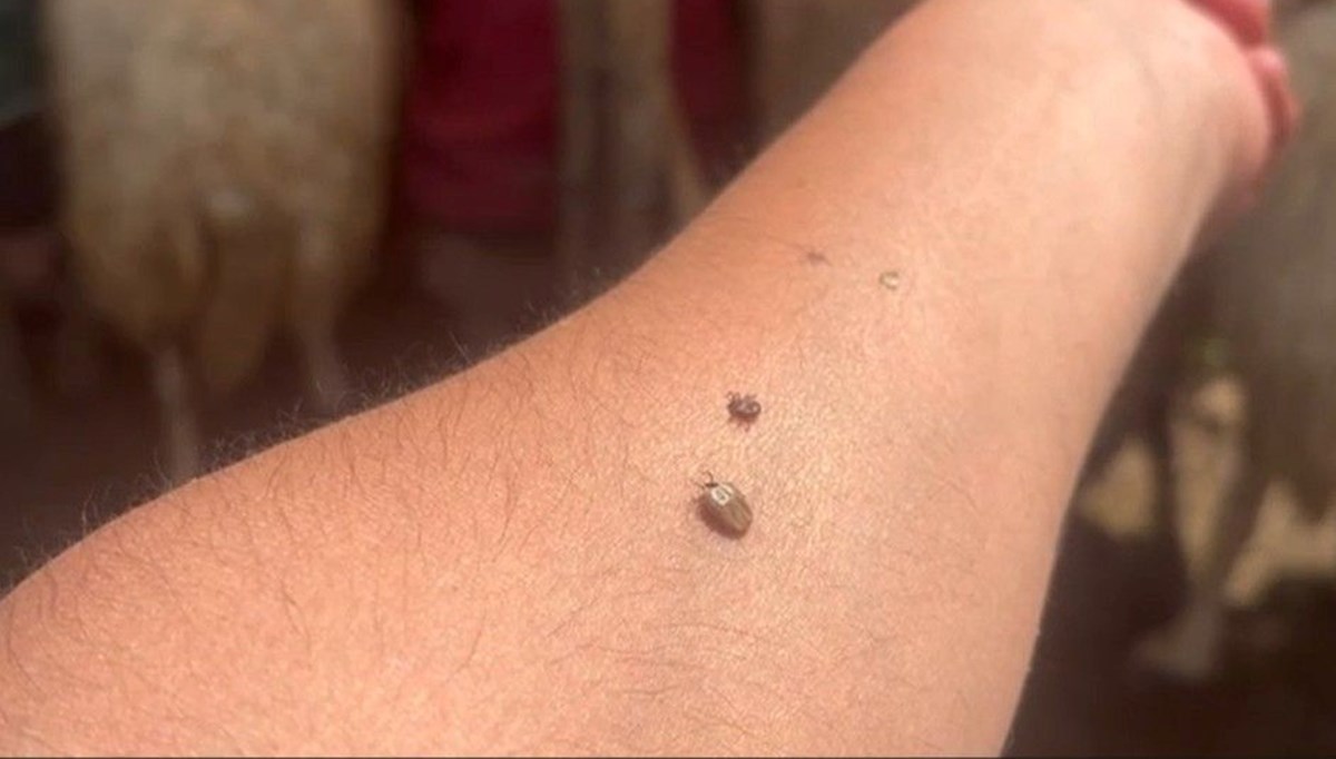 Kenelere karşı uzmanından uyarı: Kapalı giysileri tercih edin