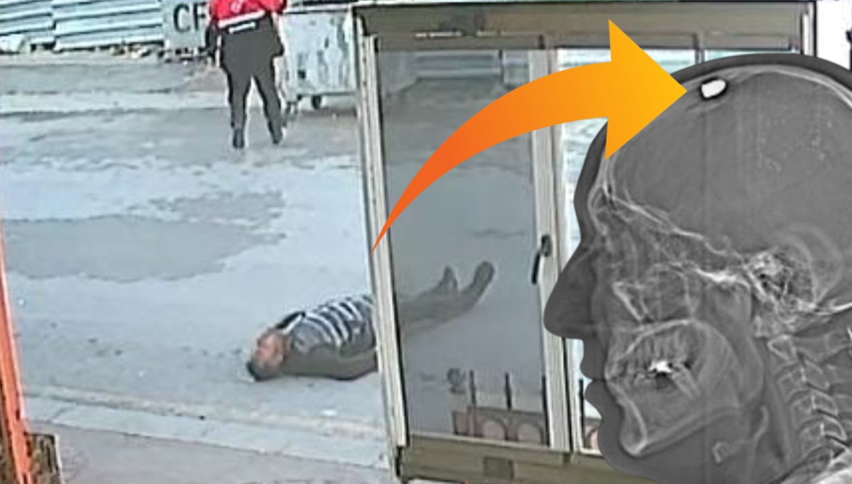 Silahla başından vuruldu, ölü taklidi yapıp kurtuldu! Silahla başından vuruldu, ölü taklidi yapıp kurtuldu!