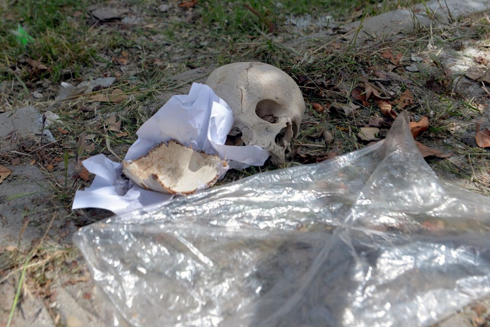Sitenin çöpünden kafatası çıktı: Bir çocuğa ilişkin olduğu düşünülüyor 76 vqmjheZ ckqKYi 71fe0lQ