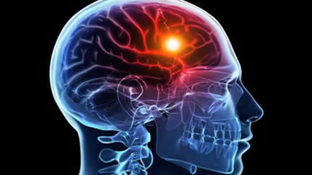 damar hastaliklarindan basit onlemlerle