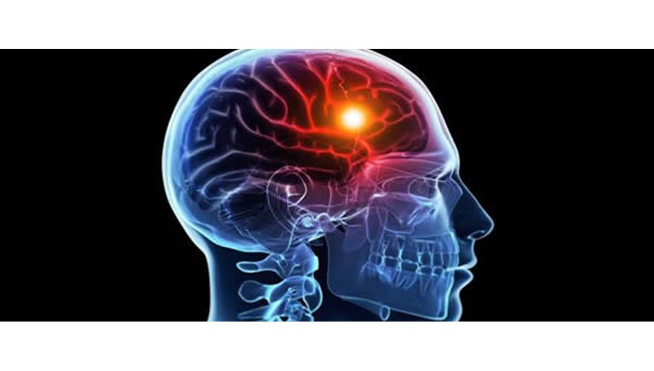 damar hastaliklarindan basit onlemlerle