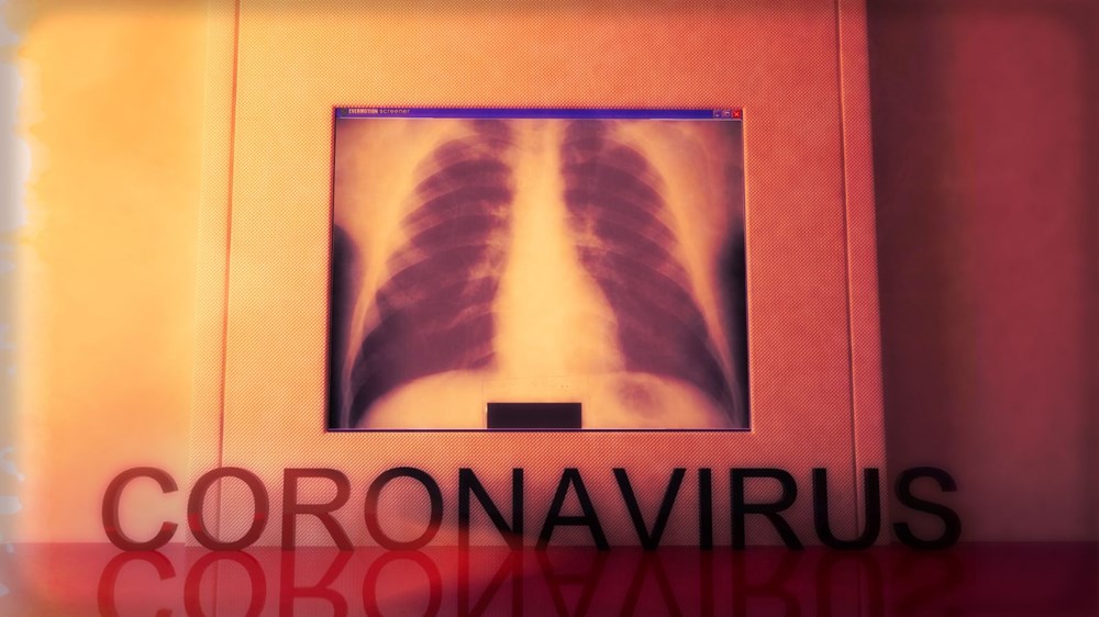 Gün gün corona virüs belirtileri nelerdir? | Covid-19 belirtileri nelerdir? - 11