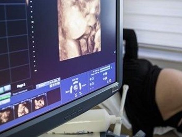 sgk ile ozel hastaneler arasindaki dogum sancisi ni bitiren karar