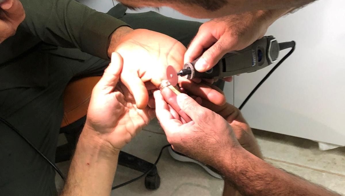 Sıkışan yüzüğü ekiper çıkarttı