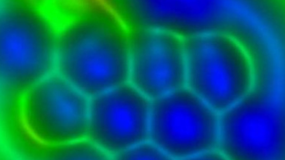 Atomun 100 Kati Cozunurlukte Ntv