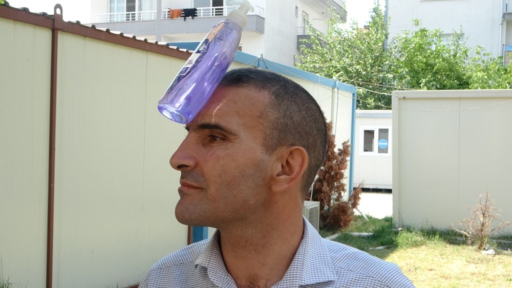 Malatyalı "mıknatıs adam" Etrafında ne varsa vücuduna yapışıyor - 5