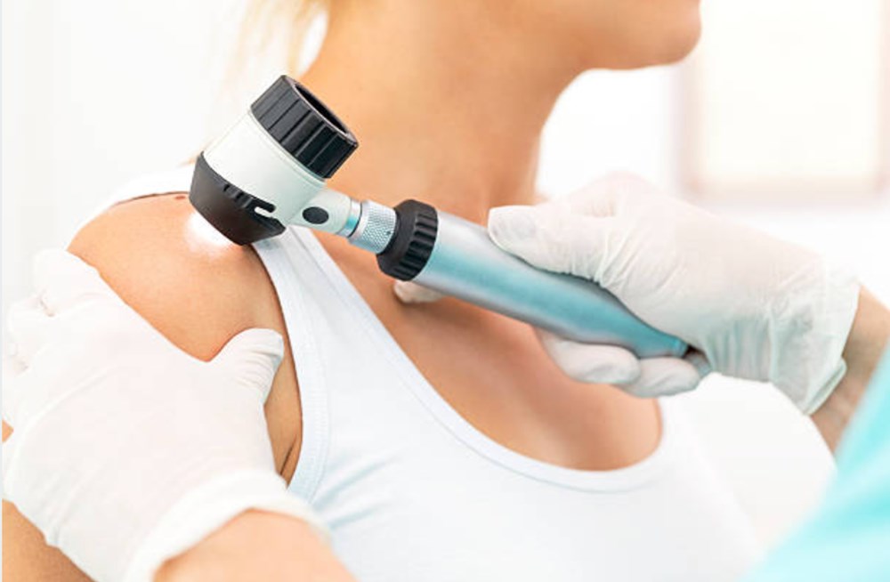 Zona hastalığı nedir? Cilt hastalıkları nelerdir? Cilt hastalıklarının belirtileri nelerdir? (Egzama, ürtiker, sedef, zona) - 4