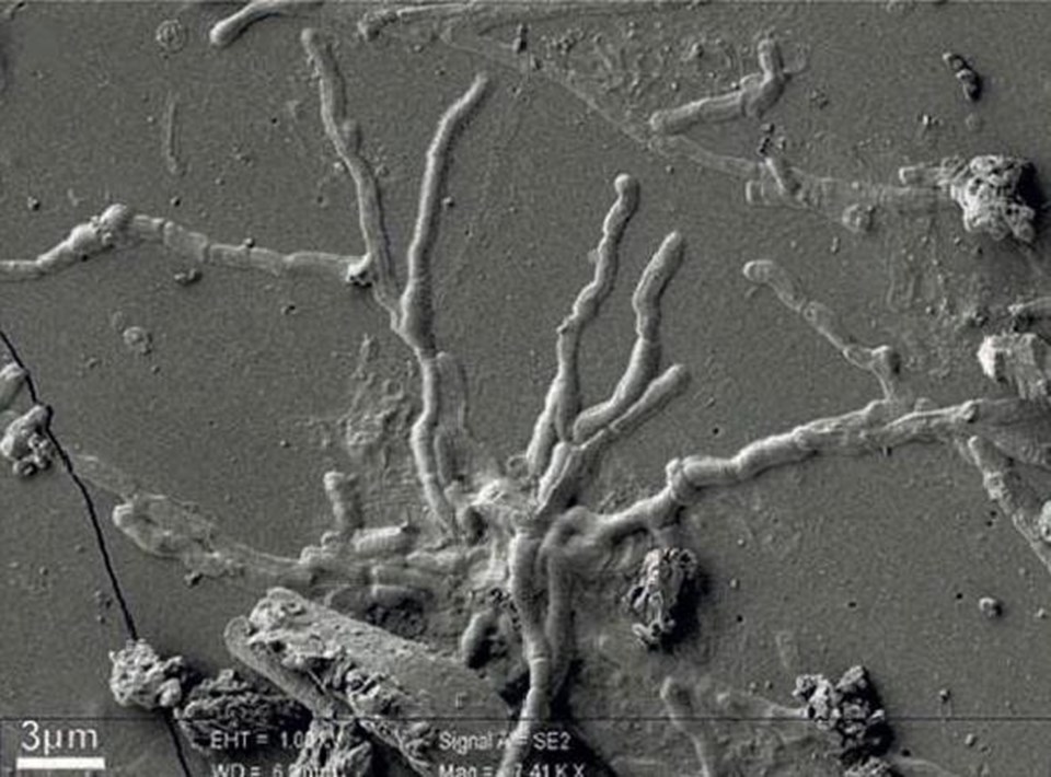 Vezüv Yanardağı patlması sırasında hayatını kaybetmiş 25 yaşındaki adamın 2000 yıldır bozulmamış olan beyin hücrelerinin yakın çekimi. 