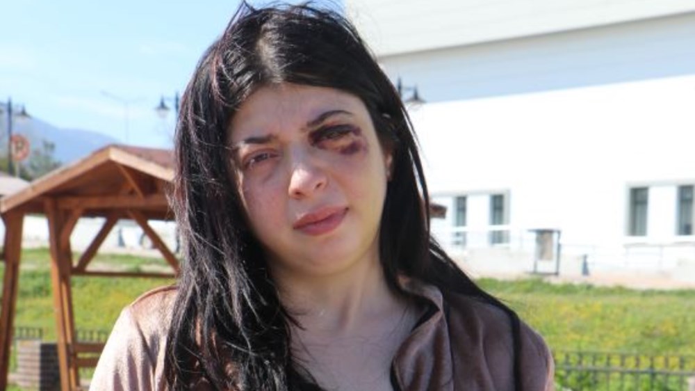 Sokak Terörü Diyeti: Tacizin Ardından Damla'nın Üç Aylık Sıvı Beslenme Mücadelesi 73