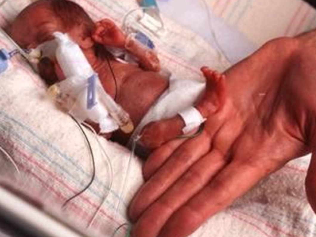 premature bebekleri bekleyen sorunlar saglik haberleri ntv