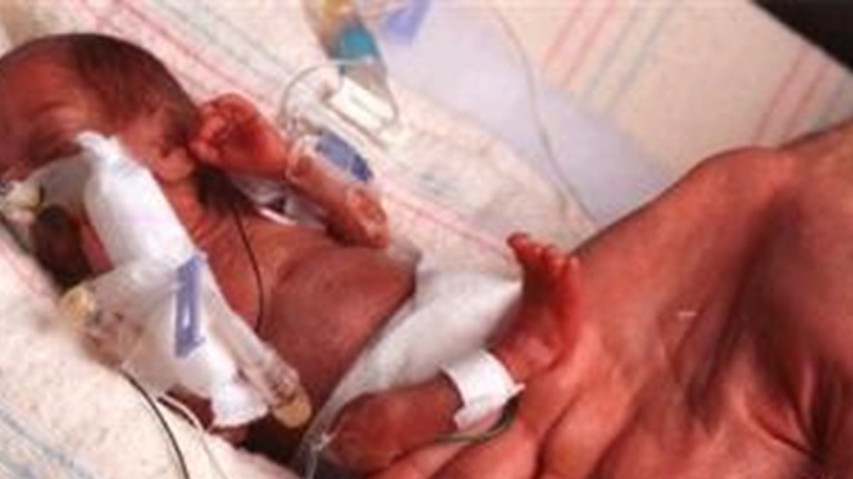 premature bebekleri bekleyen sorunlar