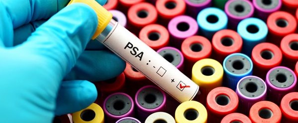 PSA testi prostat kanserinde erken tanı imkanı sağlıyor