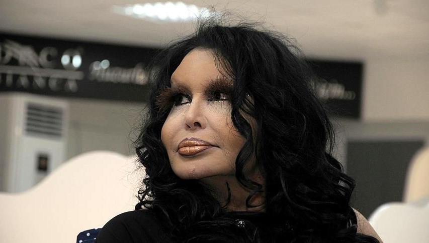 Mide kanaması geçiren Bülent Ersoy'un sağlık durumu hakkında açıklama