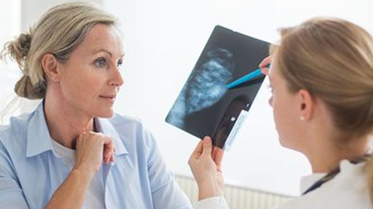 Meme Kanserinde Erken Tani Omru 7 Yil Uzatiyor Tedavi Maliyetini 7 Kat Azaltiyor Saglik Haberleri Ntv