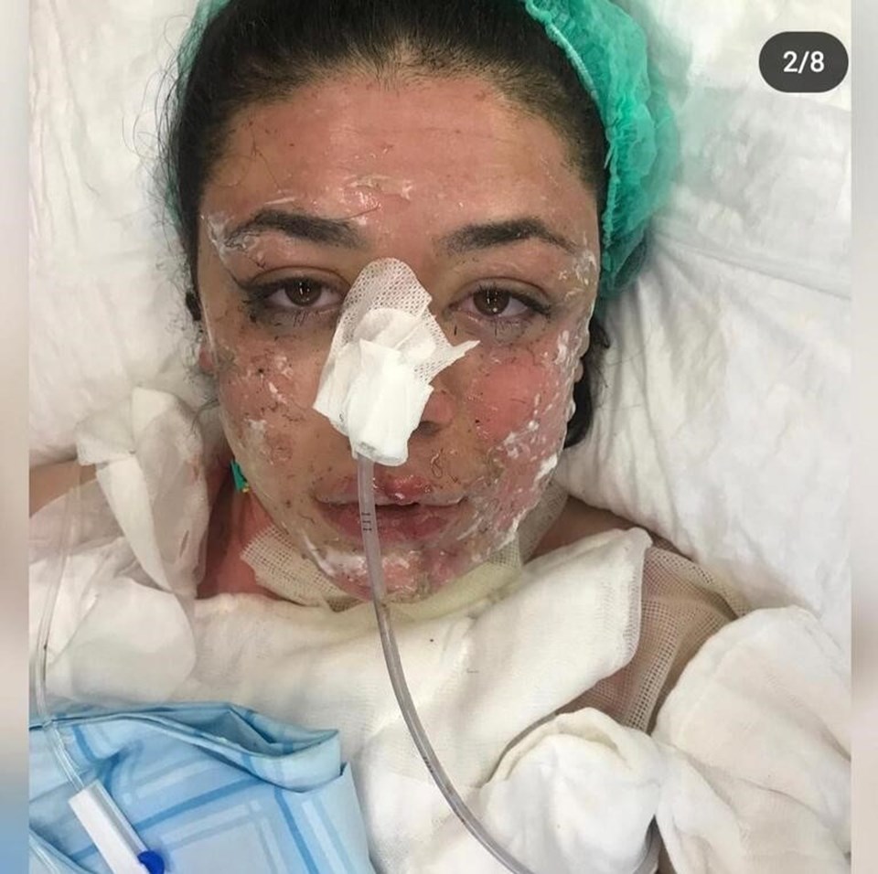 Acil serviste dehşeti anlattı: Çakmak çakıp 'Yakayım mı sizi' diye sormuş - 2