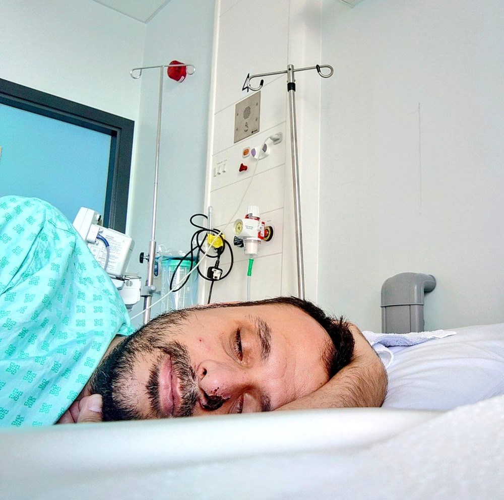 Dünyanın konuştuğu hasta: Önce HIV ve Covid sonra da maymun çiçeği - 3