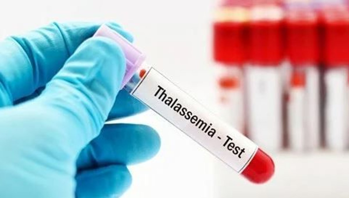 Akdeniz anemisi (Talesemi) nedir?