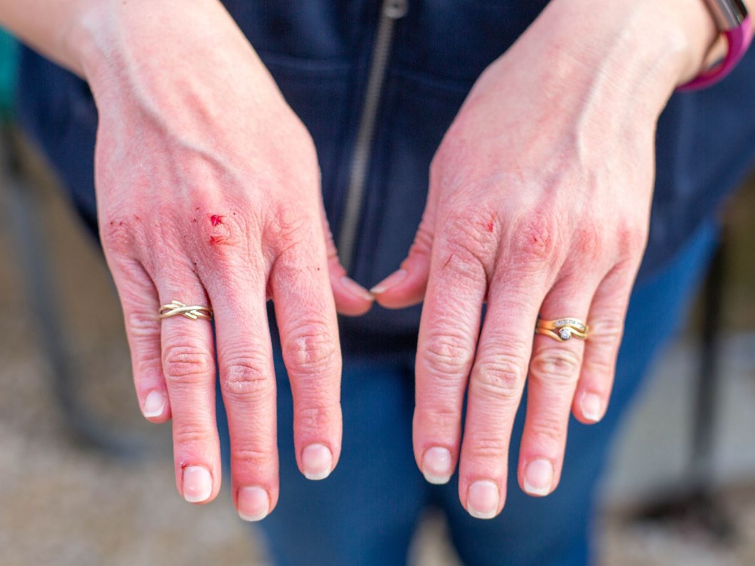 Doc Dr Kutlubay Uyardi Kurdesen De Corona Virus Belirtisi Olabilir Saglik Haberleri Ntv