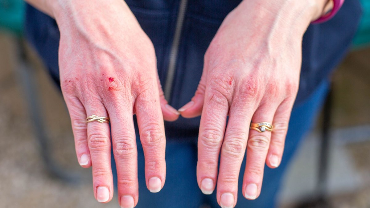 corona virus belirtisi olabilir