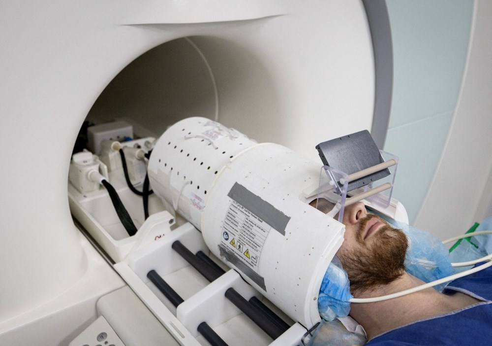 İnsan beyninin en net görüntüsü yayınlandı: Dünyanın en güçlü MRI cihazıyla çekildi - 1