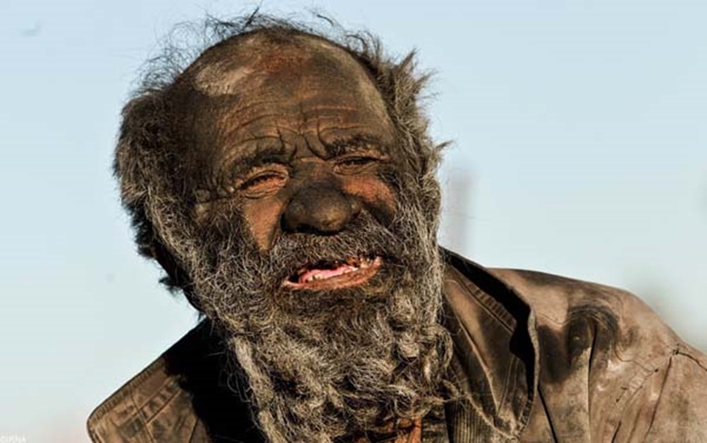 65 yıldır yıkanmayan adam: Amoo Hadji - 6