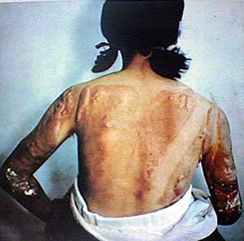 İnsanlığın kaybettiği yer: Hiroşima - 21