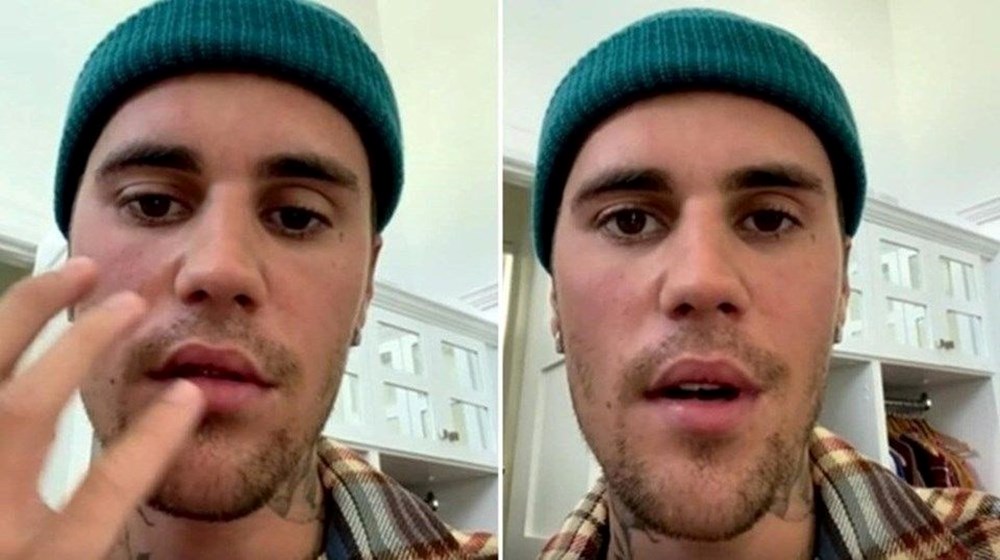 Justin Bieber'ın o fotoğrafları hayranlarını endişelendirdi - 6