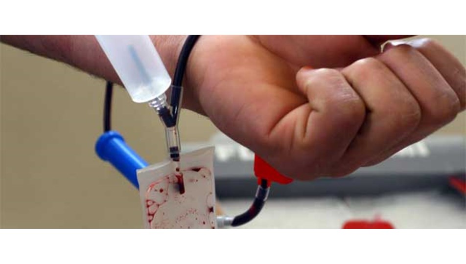 Kızılay'dan HIV'li kan açıklaması