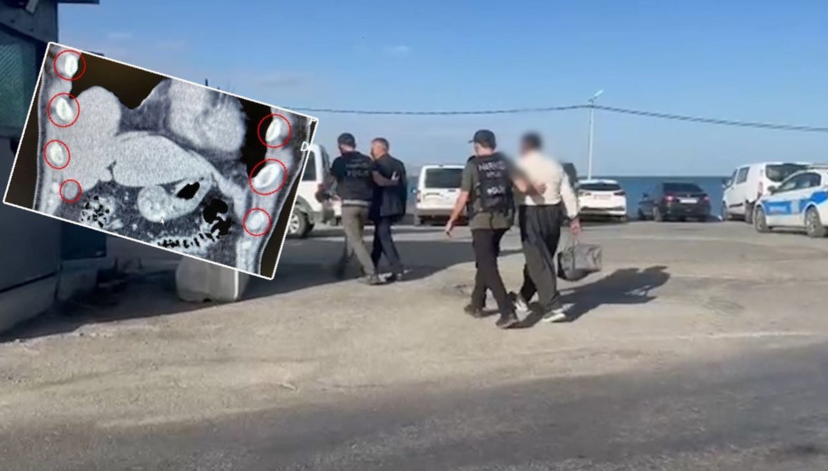 İki şüphelinin midesinde uyuşturucu bulundu