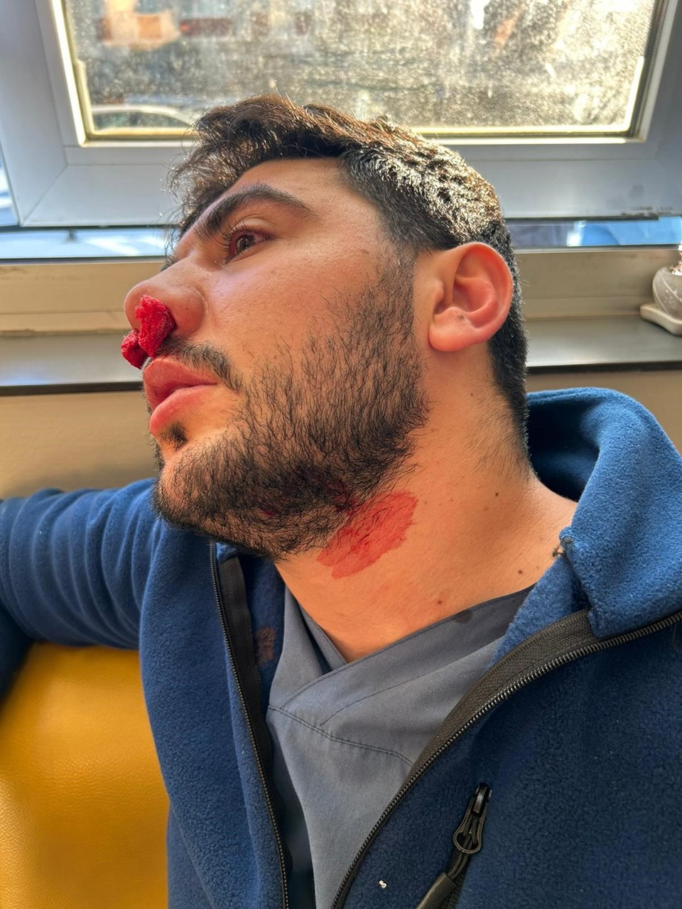 İstanbul'da hasta yakınından hemşireye yumruklu saldırı - 1