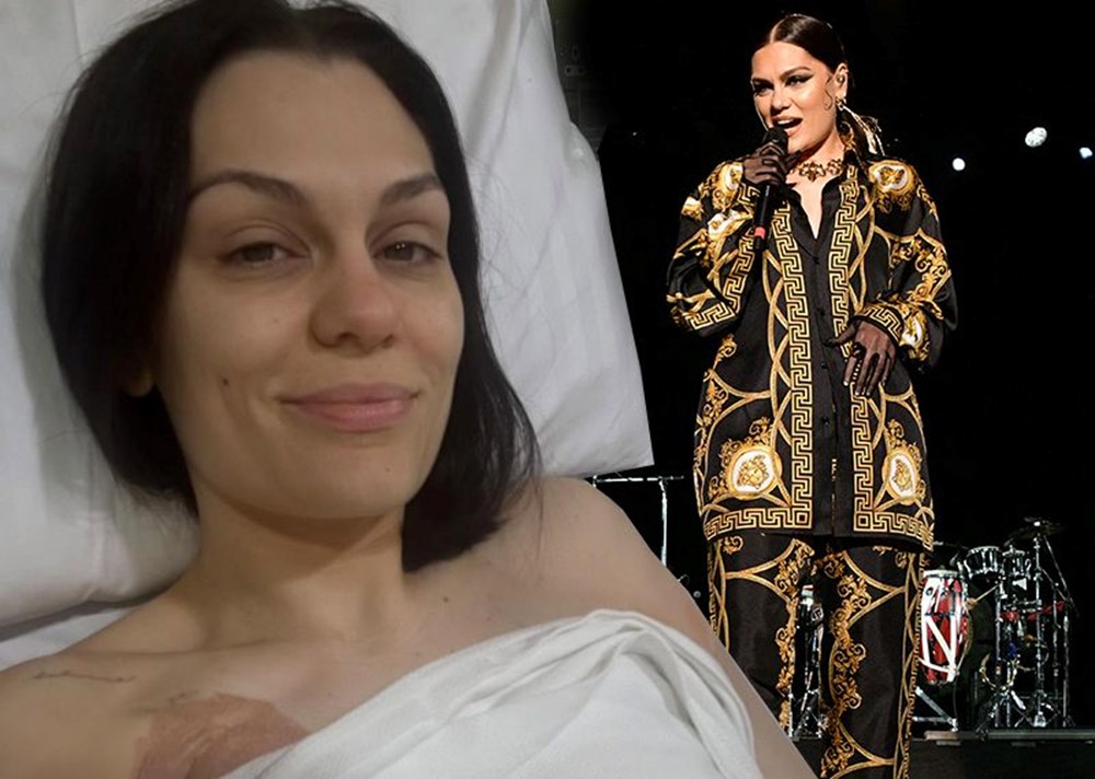 Kanserle mücadele eden şarkıcı Jessie J ameliyat oldu - 1