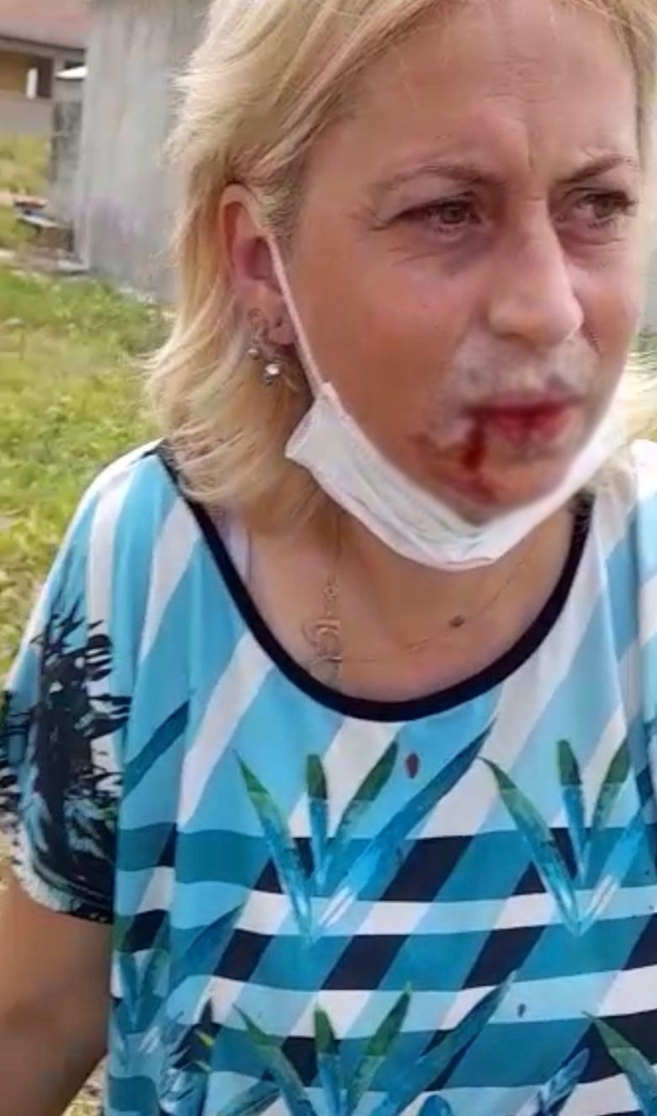 Sokak hayvanlarını besleyen kadını dövdüler - 1