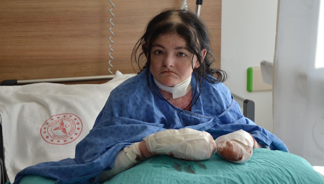 20 yıldır parmaklarını kullanamıyordu: Amerikalı Arias Türkiye'de şifa buldu