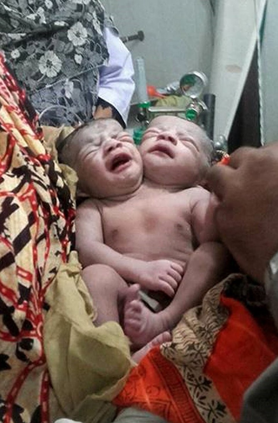 Sağlık durumu şu an için iyi olan bebek başkentteki bir hastanede gözetim altına tutuluyor.