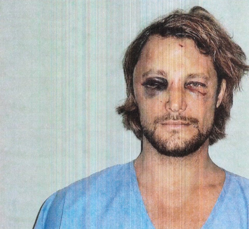 Gabriel Aubry, şiddete uğradığını kanıtlayan fotoğraflarla mahkemeye başvurdu.