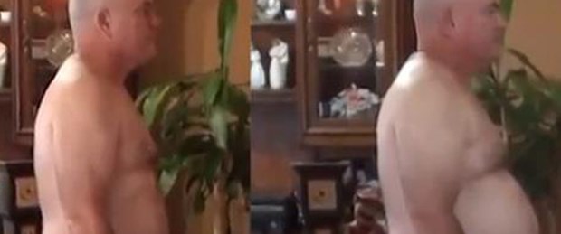 Hamburger yiyerek 17 kilo verdi