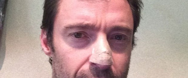 Hugh Jackman deri kanserine yakalandı