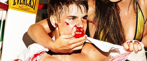 Justin Bieber’dan kanlı boks maçı