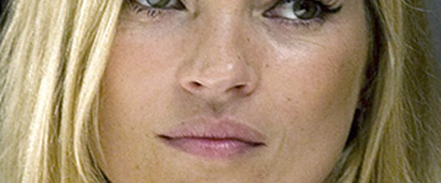 Kate Moss felç geçirdi