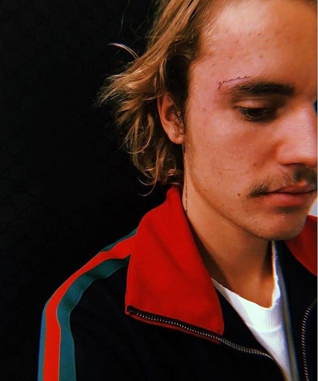 JUSTIN BIEBER