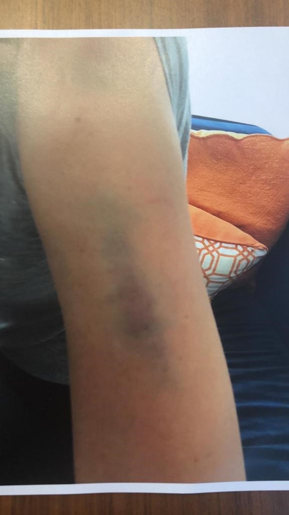 Sıla, kollarındaki morlukları içiren fotoğrafları da delil olarak sundu.