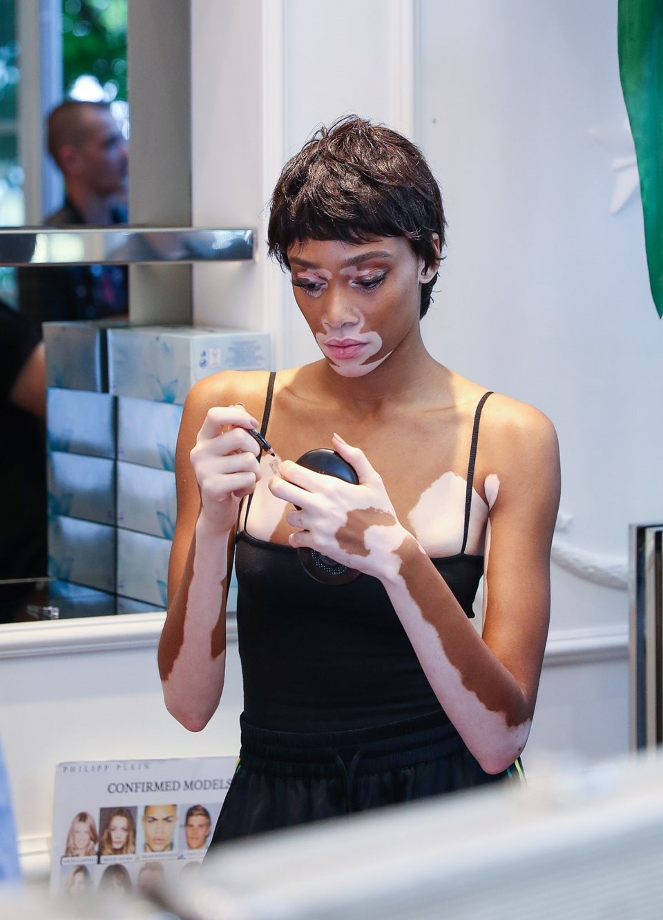 Winnie Harlow, Vitiligo hastalığı